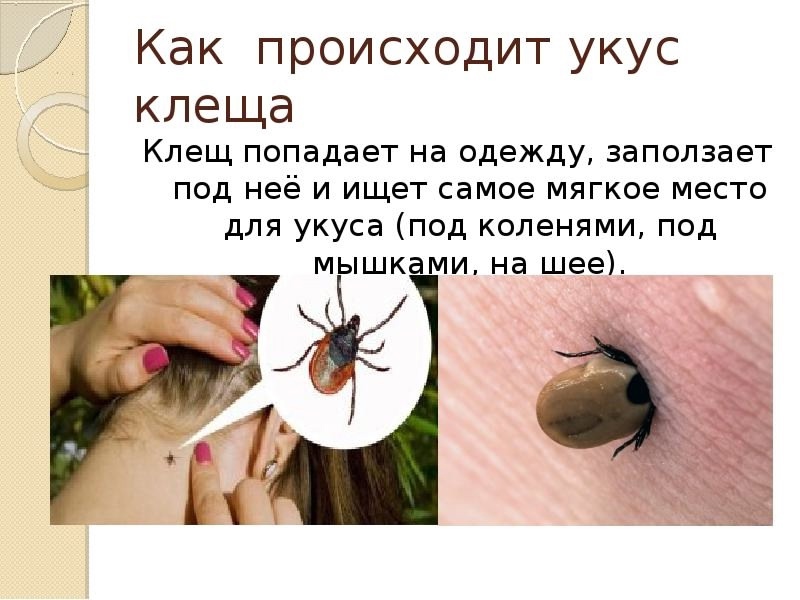 Что делать, если клещ уже присосался.