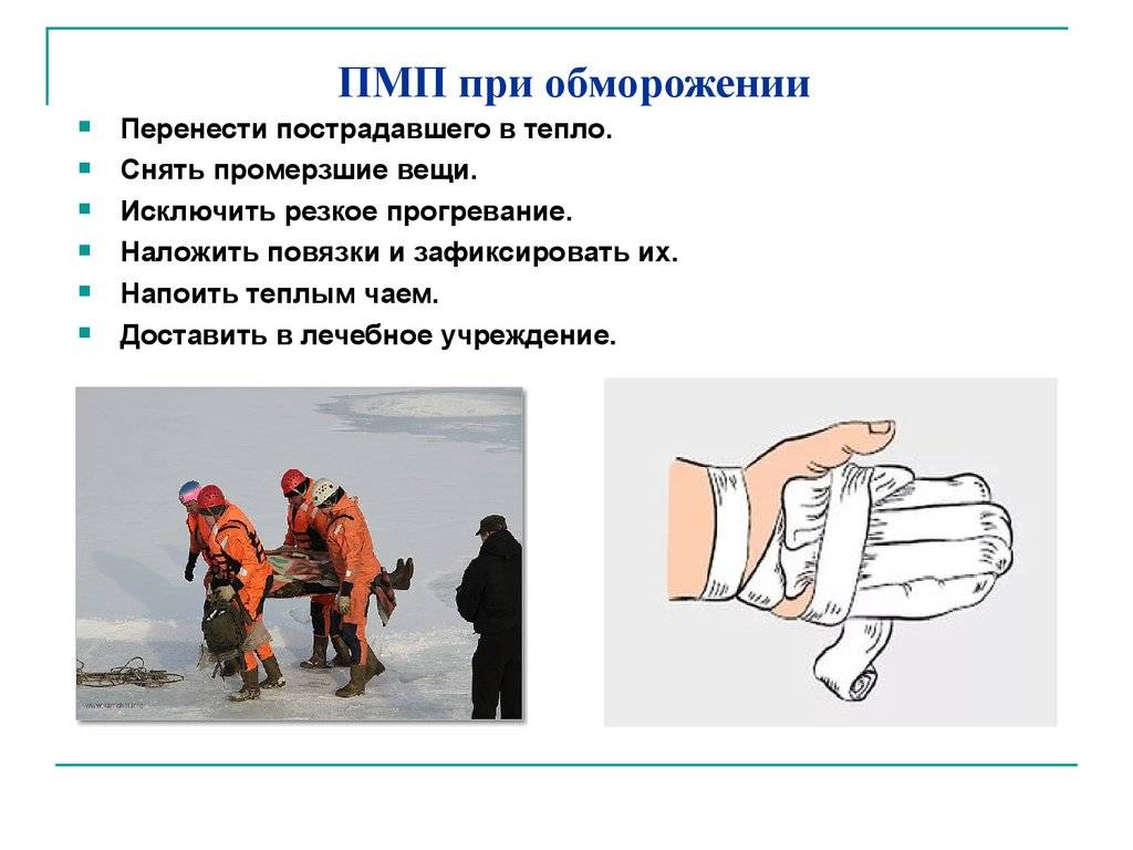 Первая помощь при обморожении.