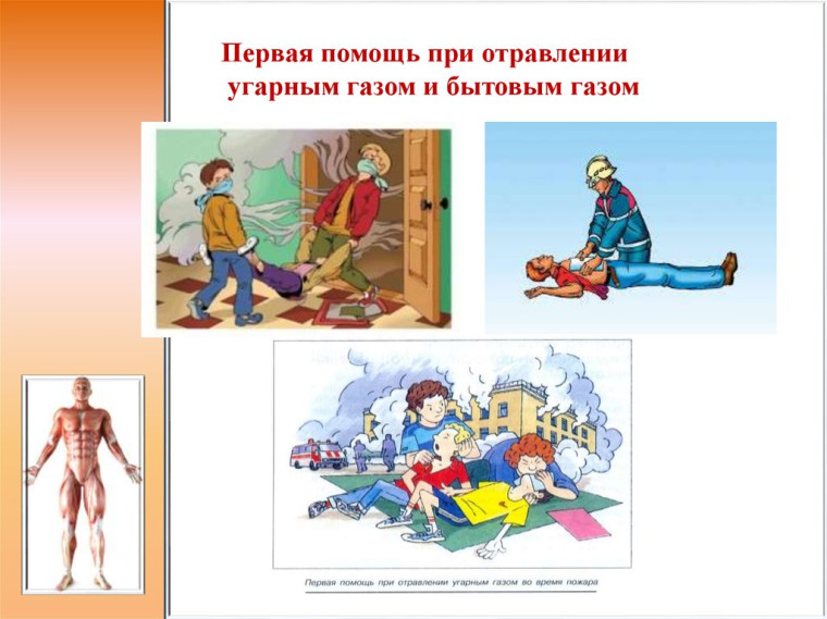 Как помочь человеку в случае отравления угарным газом. Как помочь человеку в случае отравления угарным газом.